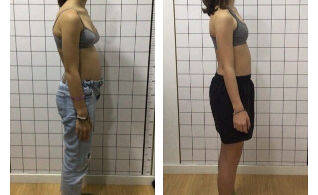 TAPAR CARA Mum&Baby Reeducação postural infantojuvenil